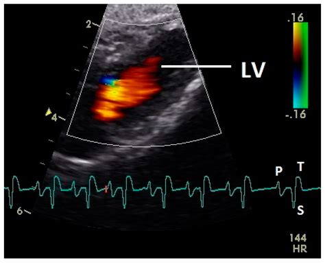 Veterinary Sciences | Free Full-Text | Color Flow Doppler ...