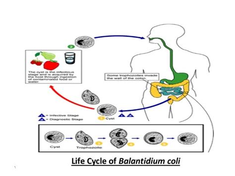 Balantidium coli