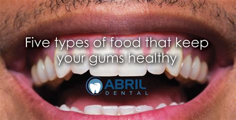 Five types of food that keep your gums healthy - Abril Dental