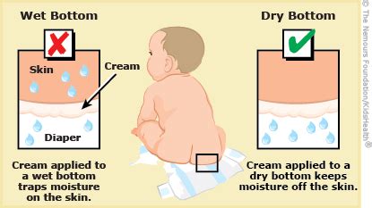 A to Z: Rash, Diaper (for Parents) - Dayton Children's