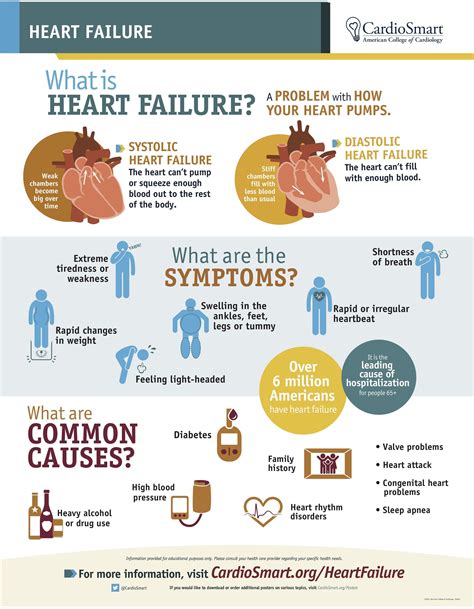 Heart Failure - Mt Vernon, IL: M. Haseeb, MD, FACC: Cardiologist