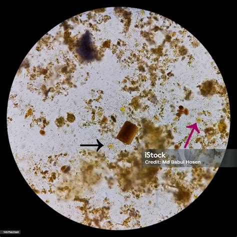 Giardia Lamblia Cysts And Trophozoite Form Muscle Fiber In Stool ...