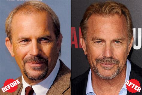 Kevin Costner Hair Loss - HAIRSXE