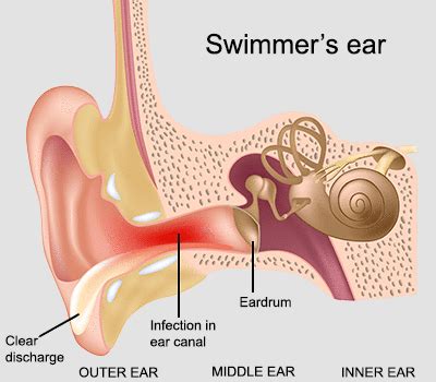 Water stuck in ear for days 2021