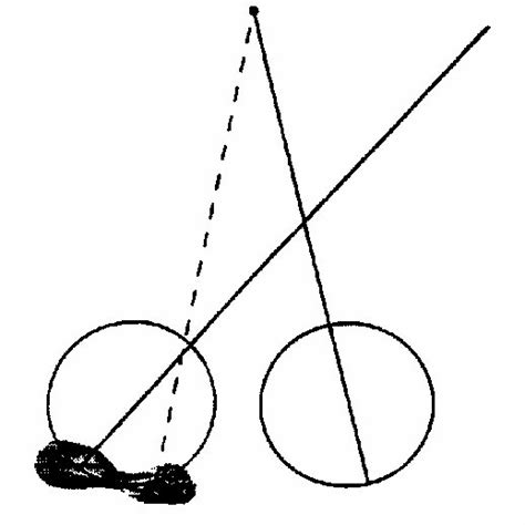 5 . The Unilateral Cover Test. (A) The cover has been removed from the ...