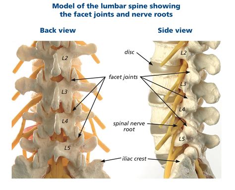 Facet Joint Disease - Spines Dorset