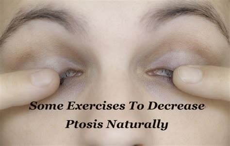 Eye Makeup Tips For Ptosis | Makeupview.co