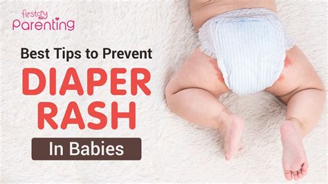 Can Poop Cause Diaper Rash at Jessica Lopez blog