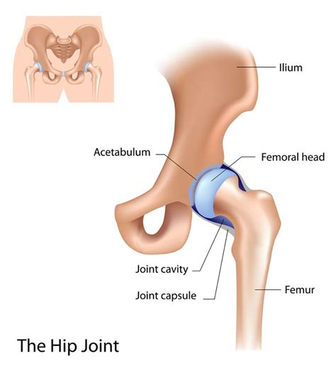 Hip pointer: Mechanism of injury, signs, symptoms and treatment | Dr Geier