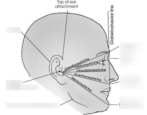 RADR 2431 Skull Lateral landmarks Diagram | Quizlet