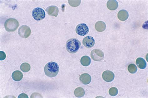 Reticulocytes using vital stain | Medical Laboratories