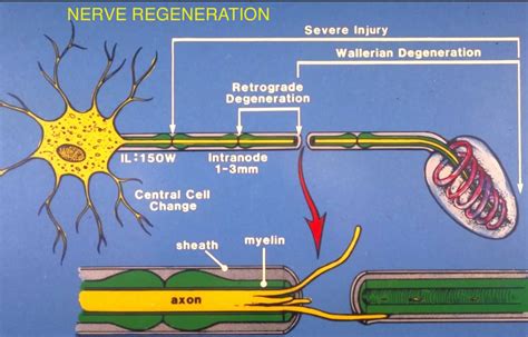 Natural Herbs & Supplements for Nerve Pain, Damage, Repair, Regeneration