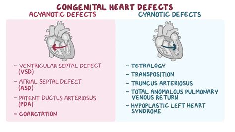 Congenital heart defects: Clinical: Video & Anatomy | Osmosis