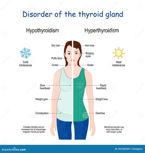 Thyroid Symptoms Stock Illustrations – 217 Thyroid Symptoms Stock ...