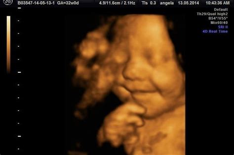 Ultrasound Captures Baby Smiling in the Womb | Christian News Network