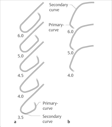 Coronary Angiography | Thoracic Key