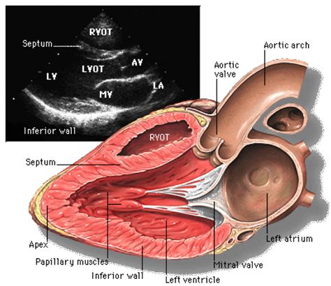 Making sense of an echocardiogram report - for GPs! — Cardiology Institute