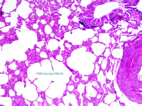 Microscope World Blog: Lungs under the Microscope