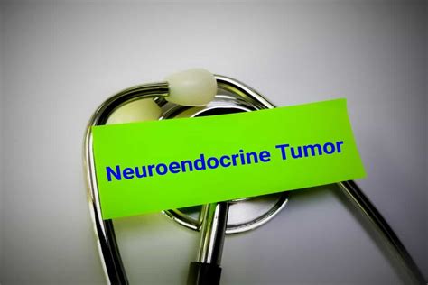 Neuroendocrine Tumor- Symptoms, Treatments, Causes & More