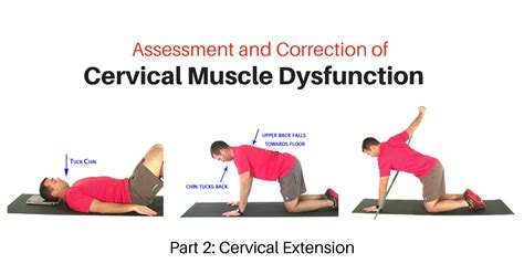 cervical extension exercises