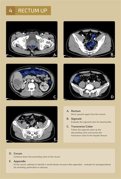 Ct Scan Of Abdomen With Contrast at John Shelby blog