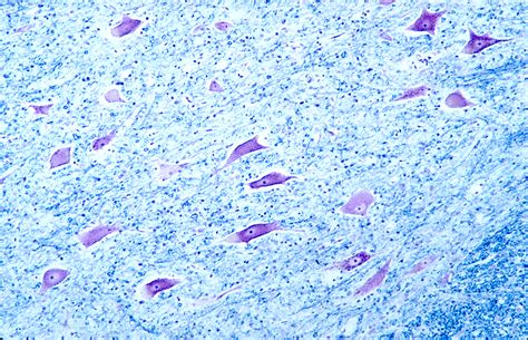 Histology: Nervous Tissue Tutorial | Sophia Learning