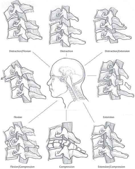 The Cervical Spine | Radiology Key