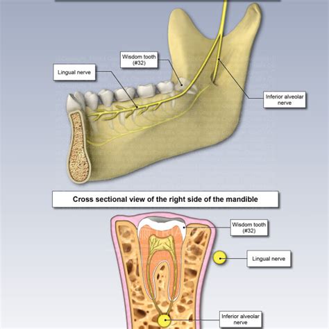 Anatomy of the Lingual Nerve - TrialExhibits Inc.