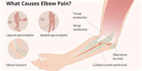 Causes of Elbow Pain and Treatment Options - Impulse Today