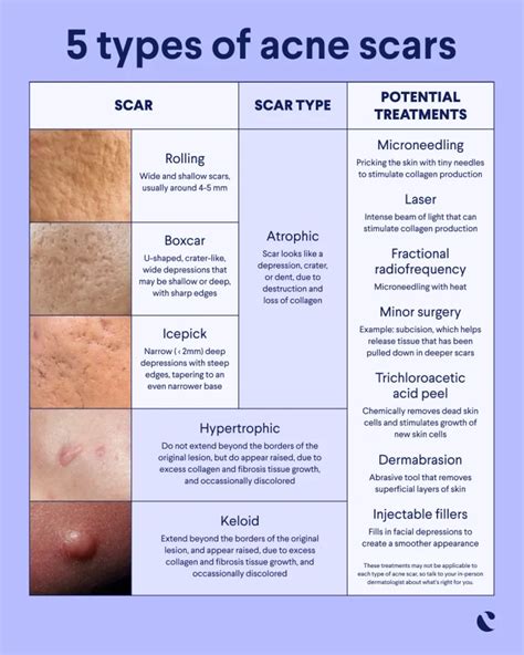 How to treat atrophic scars, according to experts