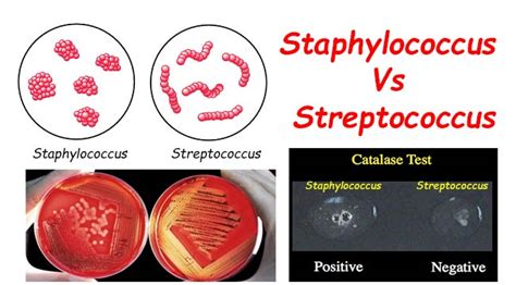 Differences Between Staphylococcus and Streptococcus - Microbiology ...