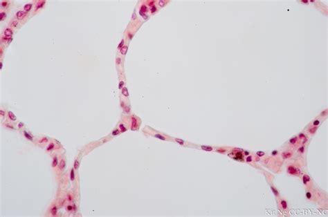 Simple Squamous Epithelium – Kit Ng, Ph.D.