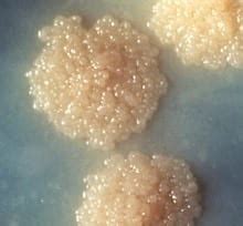 Life Cycle of Mycobacterium Tuberculosis – Mycobacterium tuberculosis