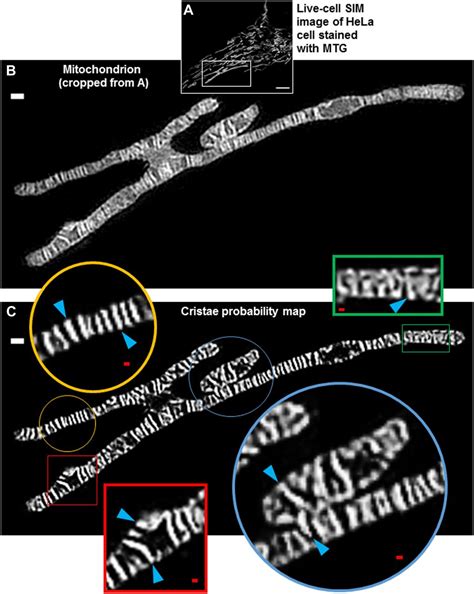 Quantification of cristae architecture reveals time-dependent ...