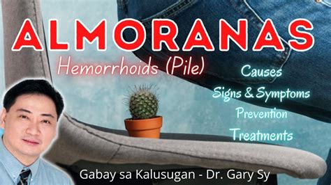 Hemorrhoids (Almoranas) - Dr. Gary Sy - YouTube