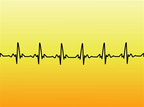 Download 20 + Ekg Vector