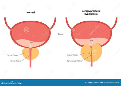 Bph Cartoons, Illustrations & Vector Stock Images - 270 Pictures to ...