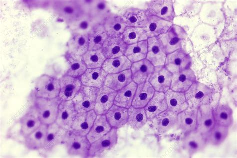 Simple squamous epithelium - Stock Image - G450/0098 - Science Photo ...