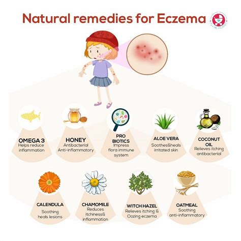 Natural Remedies For Eczema Treatment! - By Dt. Neha Suryawanshi | Lybrate