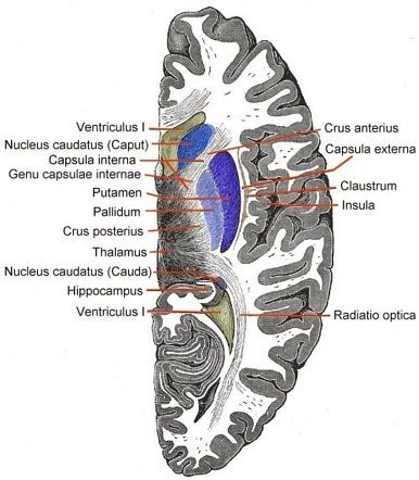 Caudate nucleus | Radiology Reference Article | Radiopaedia.org