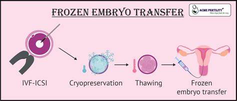 Frozen Embryo Transfer – IVF Blogs