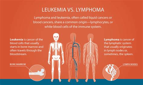 Leukemia Symptoms