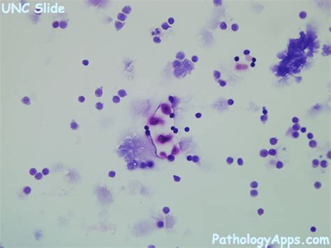 Cryptococcus Neoformans Gram Stain Morphology