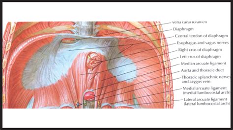 Figure 1 from Median arcuate ligament syndrome | Semantic Scholar