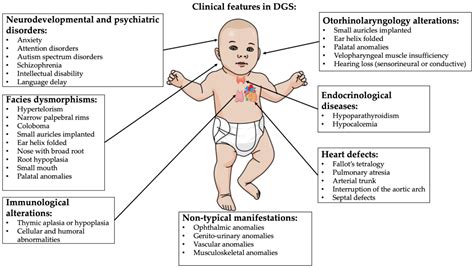 Velocardiofacial Syndrome Infant