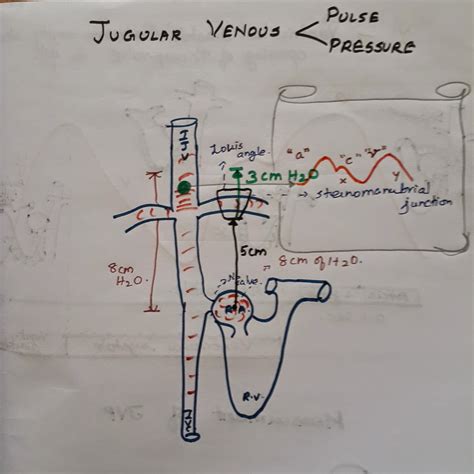 MEDGOAL: Jugular venous Pulse/Pressure ( part 2)