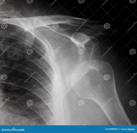 Plain Film X-ray Of Ankle In Two Projections, Radiography Royalty-Free ...