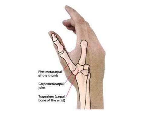 Pictures Of Carpometacarpal Joint Of The Thumb