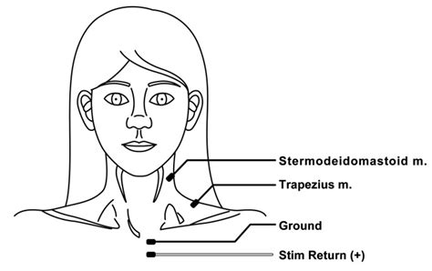 Spinal accessory cranial nerve XI monitoring, left operative side ...