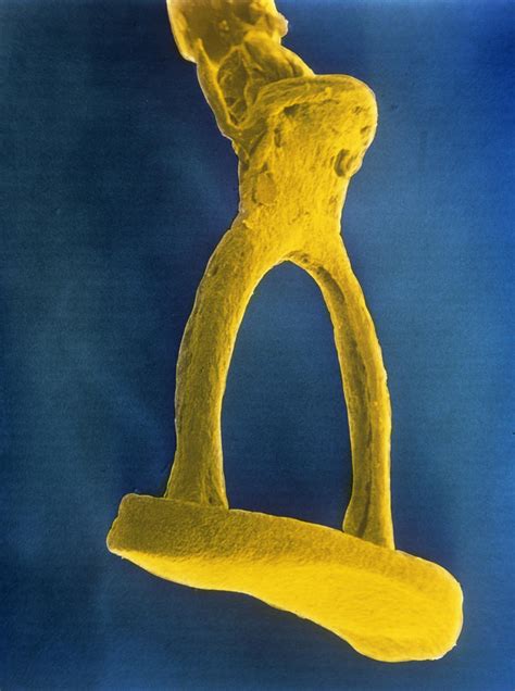 False-colour Sem Of Stirrup Bone Of The Middle Ear Photograph by Cnri